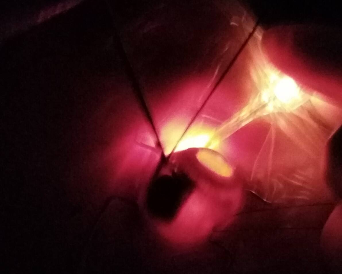 Immagine: Transilluminazione brachiterapia.jpg Creative Commons Attributon–ShareAlike 4.0 International (CC BY-SA 4.0)